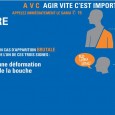 L’accident vasculaire cérébral (AVC), dit aussi «attaque cérébrale», est dû à une interruption brutale de l’irrigation sanguine d’une zone du cerveau (obstruction ou rupture d’une artère cérébrale). Les cellules du […]