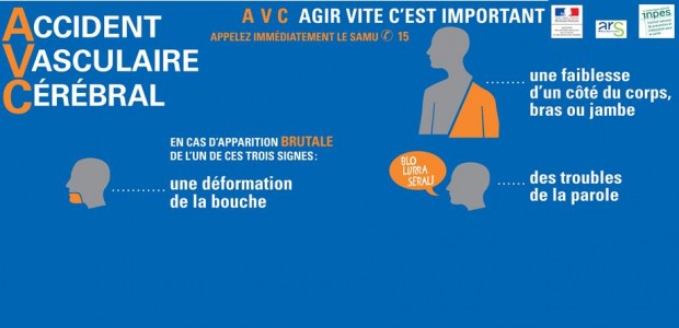 L’accident vasculaire cérébral (AVC), dit aussi «attaque cérébrale», est dû à une interruption brutale de l’irrigation sanguine d’une zone du cerveau (obstruction ou rupture d’une artère cérébrale). Les cellules du […]